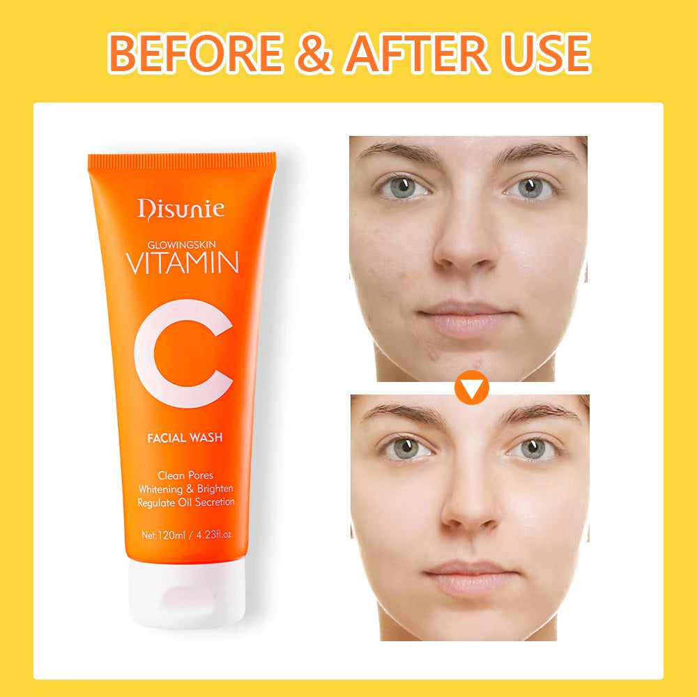 Vitamin C Amino Acid Facial Cleanser Face Glow And Cleans Whitening Brightening Oil Control Face Wash For Men Women